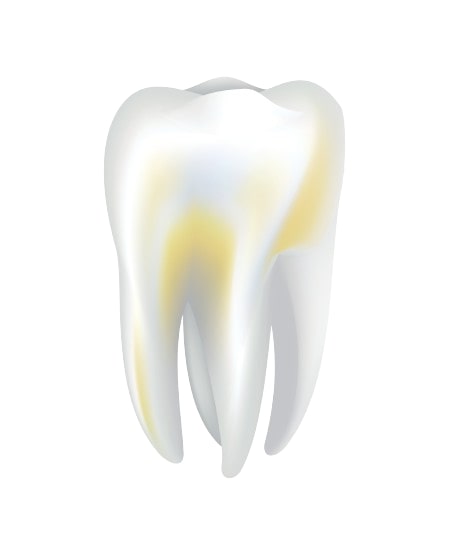 Zubni kamenac